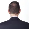 Rode HS-2P-Large Headmic